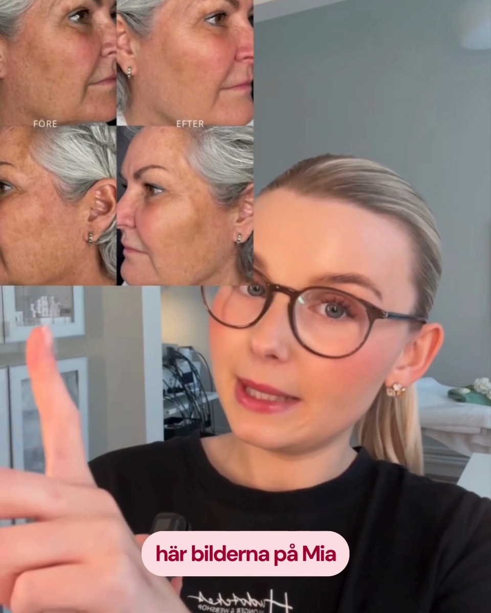 GREEN PEEL®-behandling