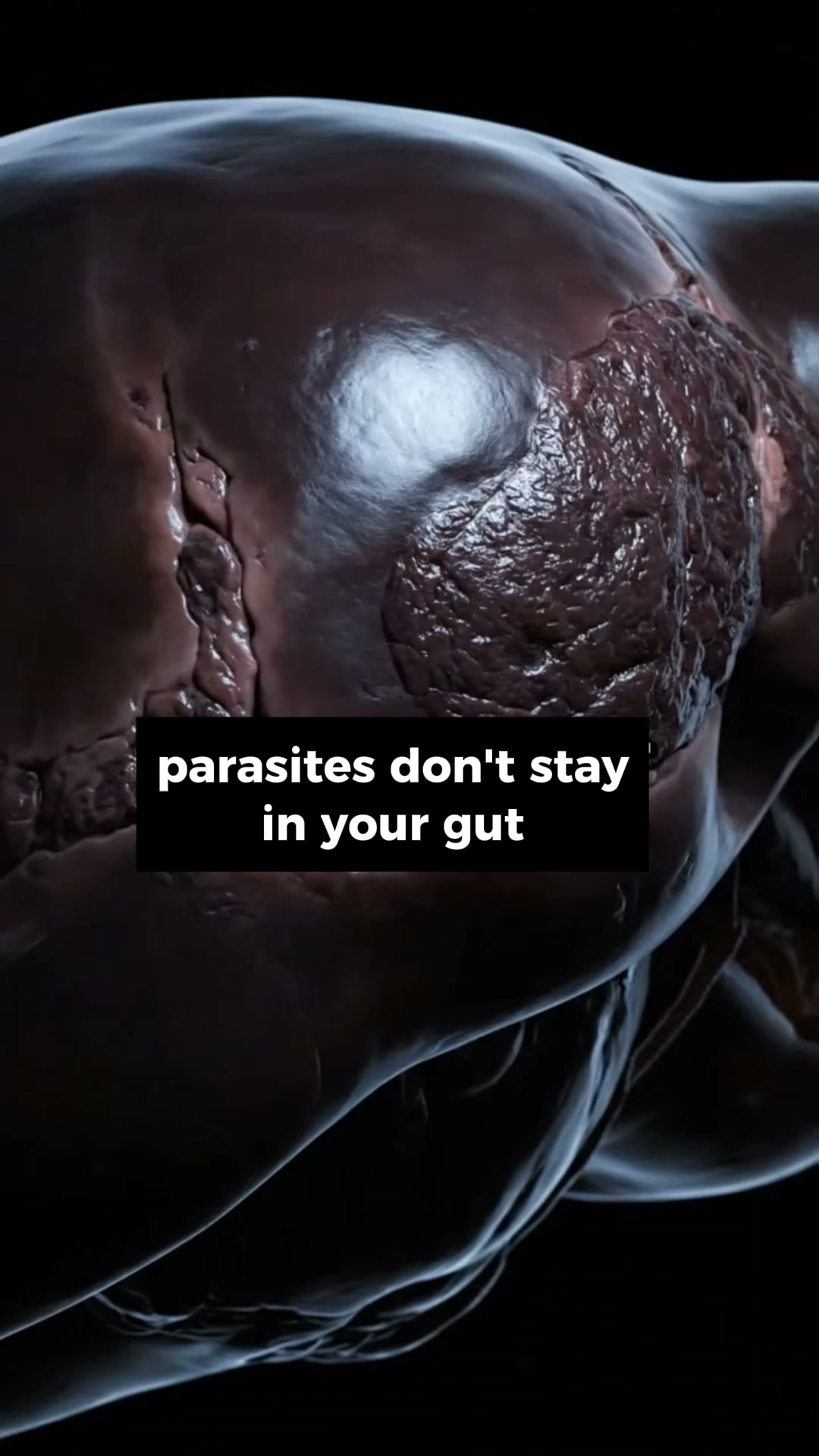 Support Your Gut. Skip the Extreme Claims.