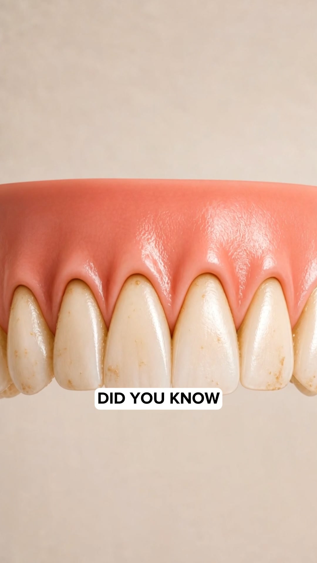 My Gums Kept Pulling Back