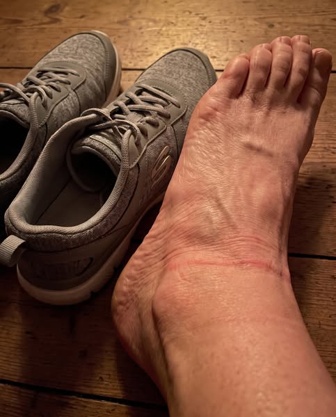 Il vero motivo per cui le scarpe stringono