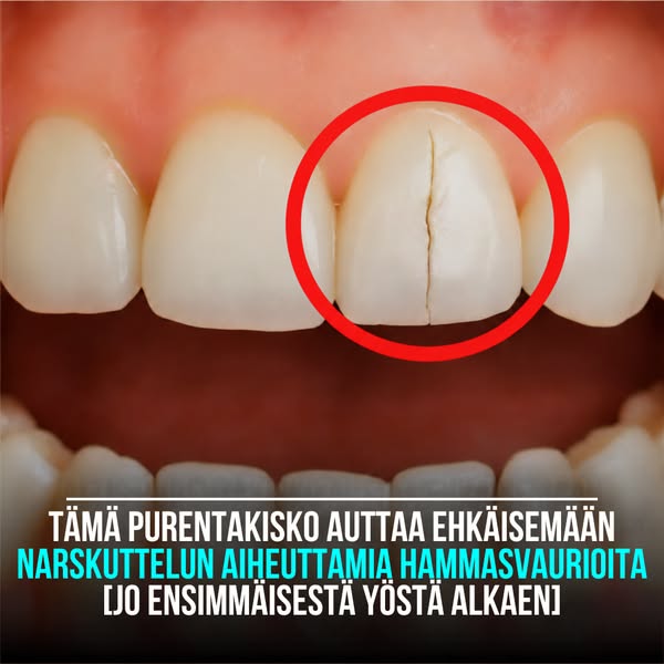 Hammaskiille ei uusiudu