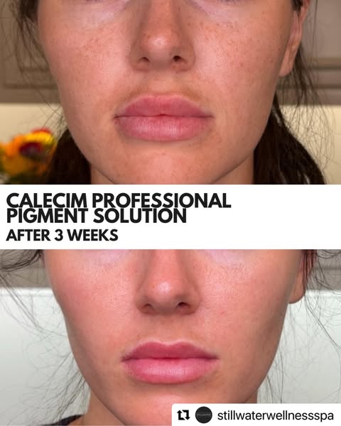 Professional Serum 5ml