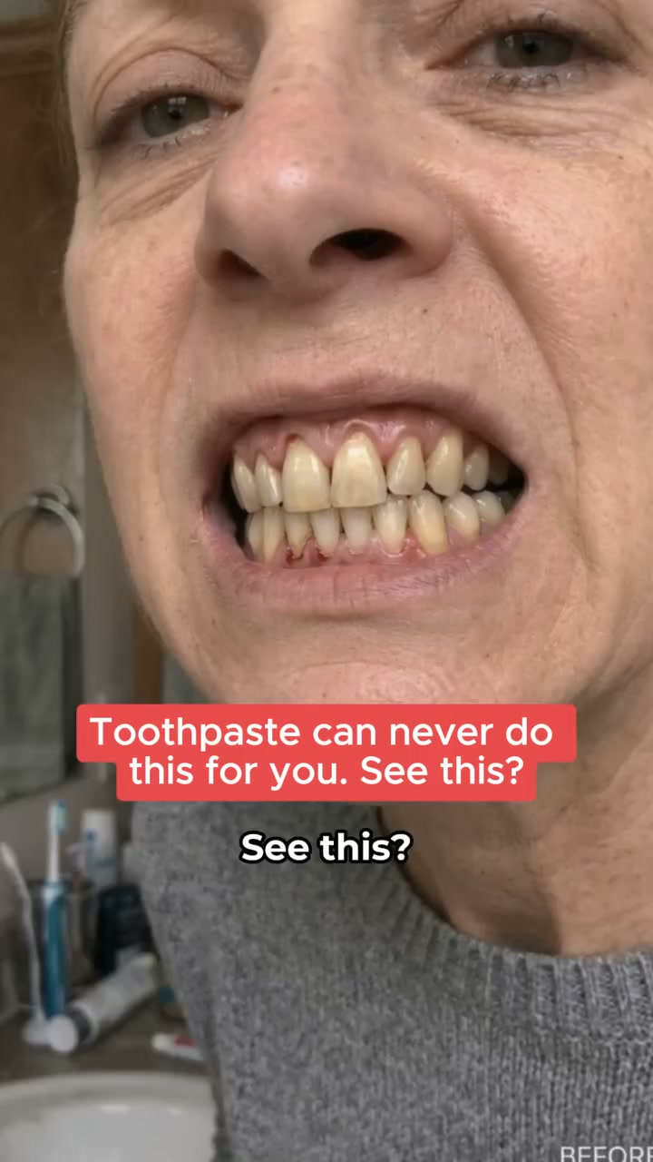 The Solution Your Gums Actually Need