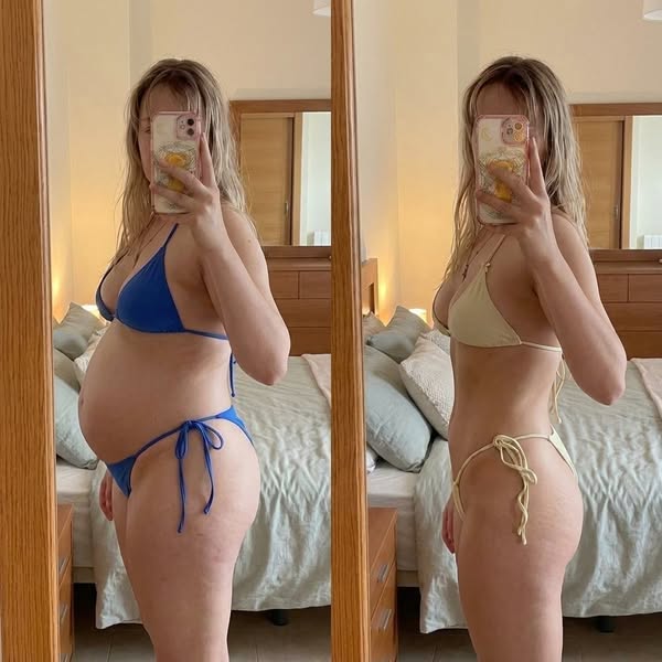 I got rid of my FUPA without dieting, surgery, orthe gym.