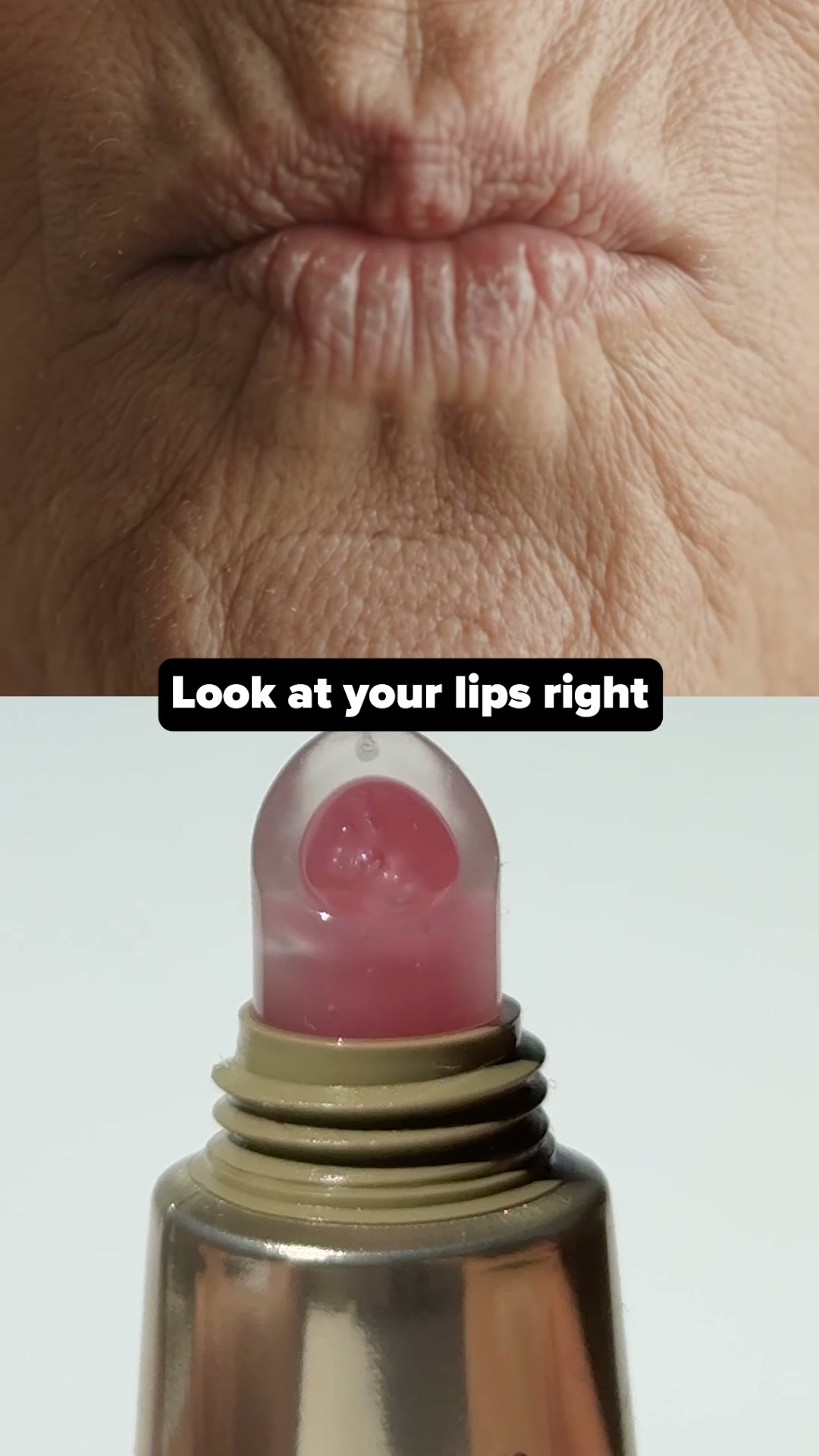 Plump Lips Shouldn't Hurt