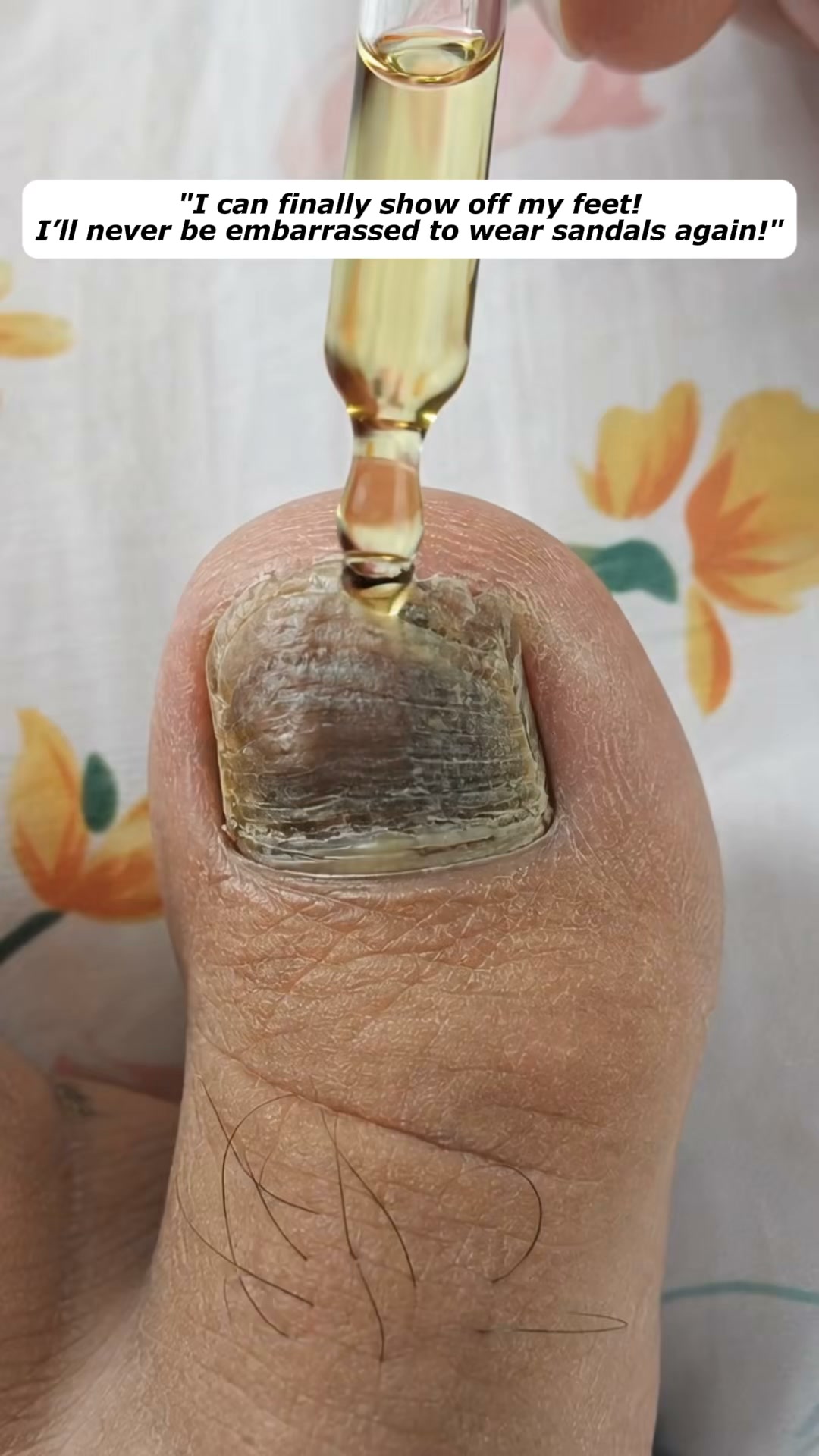 Stop hiding your nails. Start reviving them