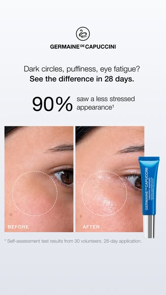 Dark circles, puffiness, eye fatigue?