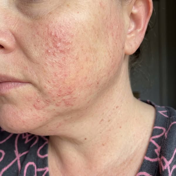 Turns out my skin was never the problem