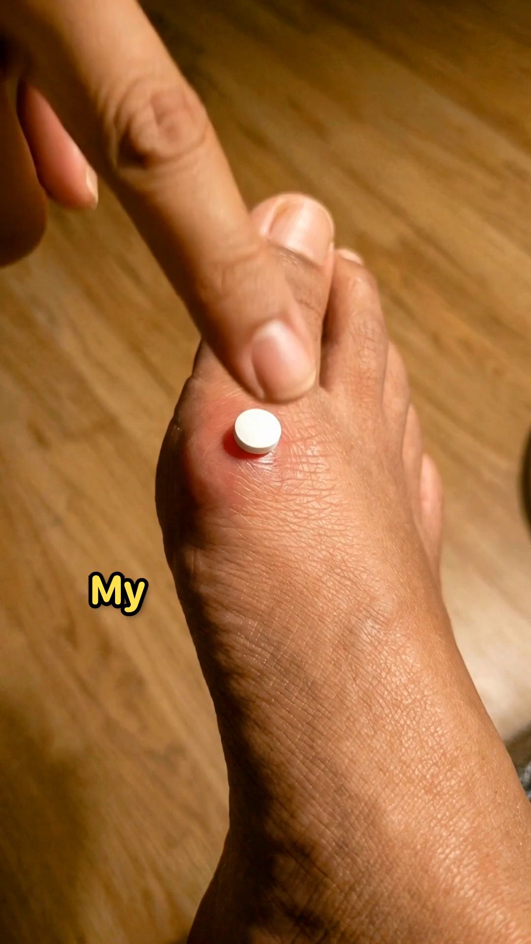 Bunion Relief Without a Pill Every Night