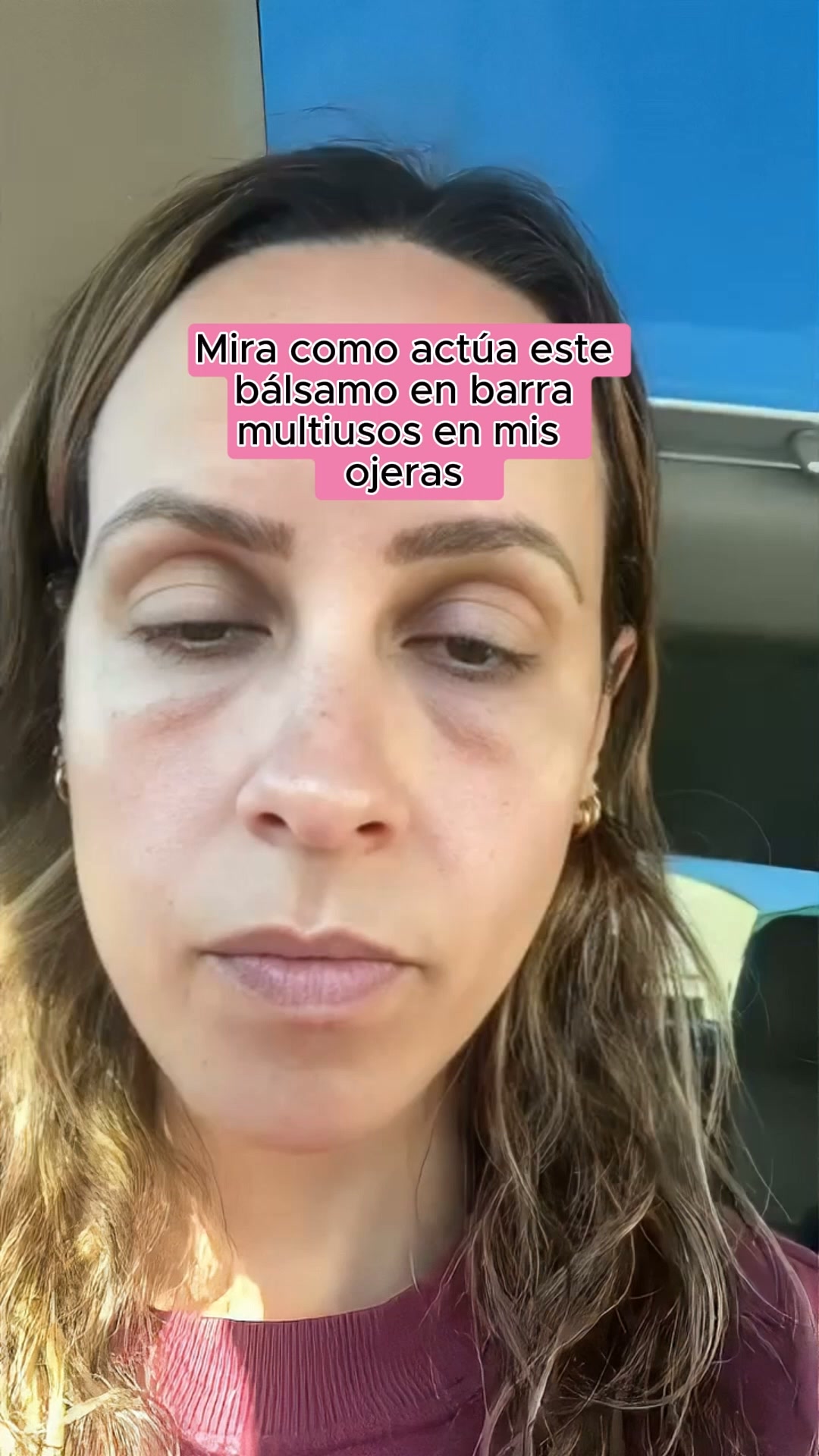 Bálsamo multiusos viral