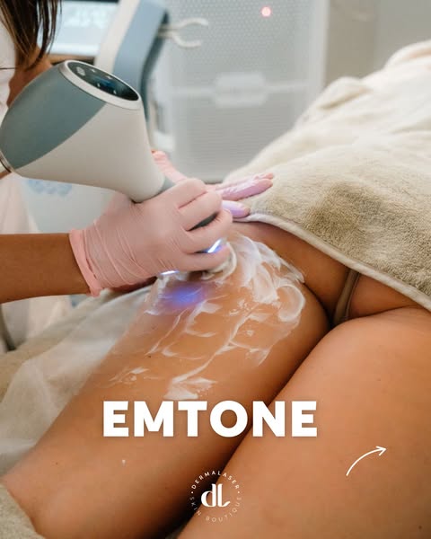 Emtone | Dermalaser