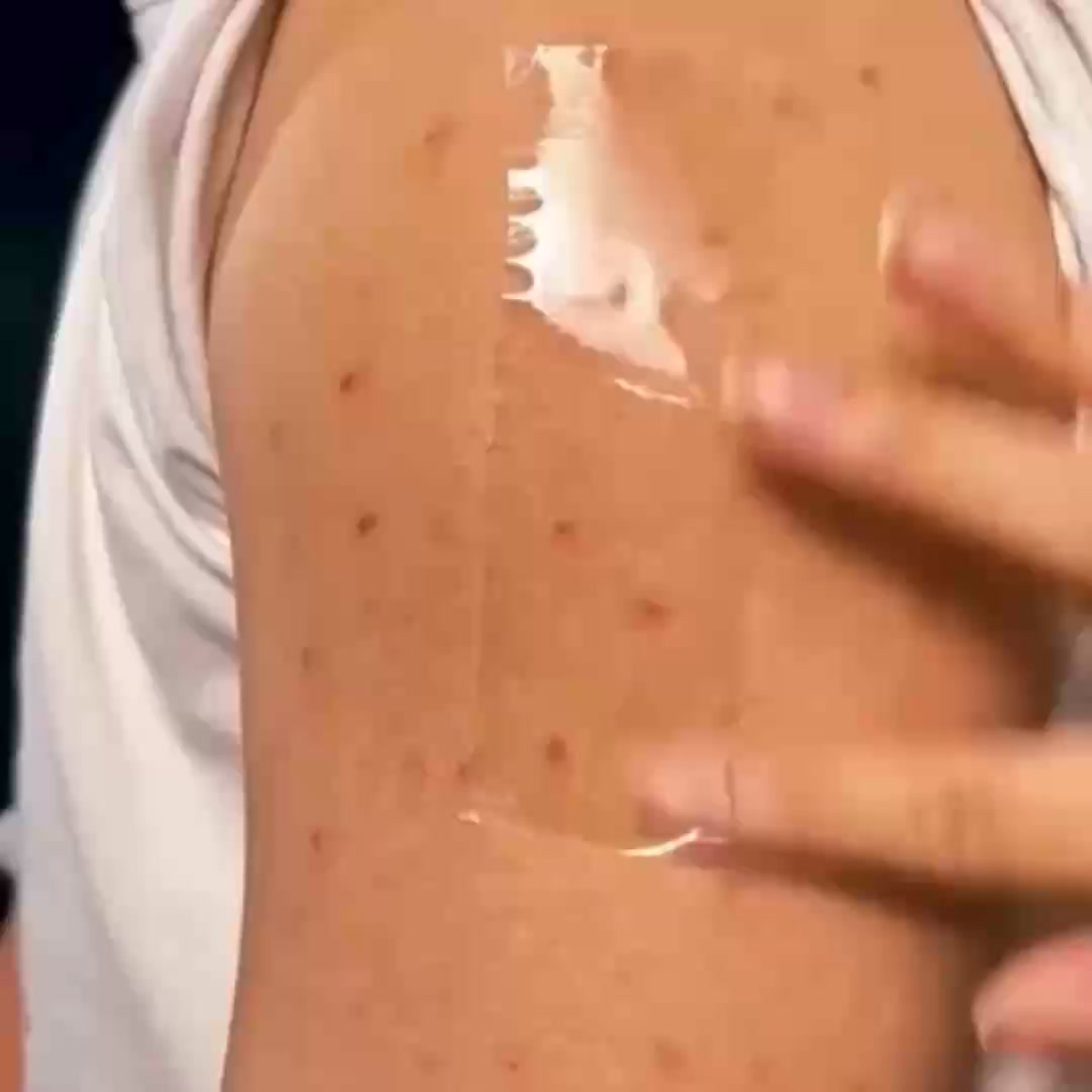 How to Stop Dark Spots Where They Start
