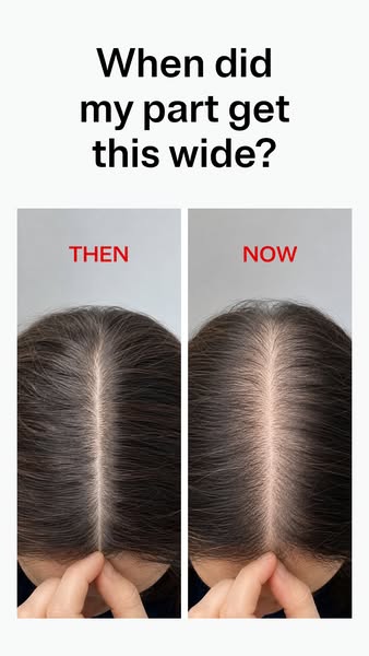 Best Hair Growth Products of 2026