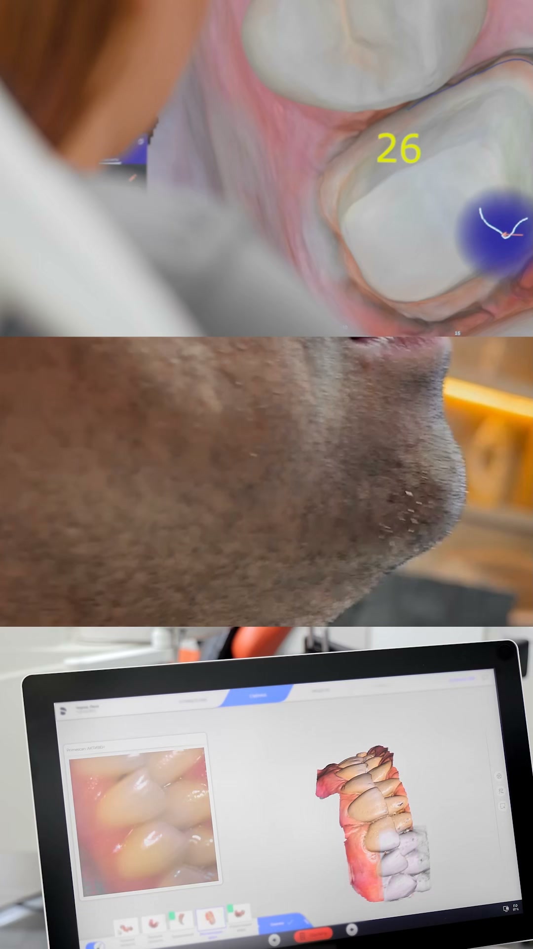 Master Occlusal Adjustments and Transform Your Clinical Results