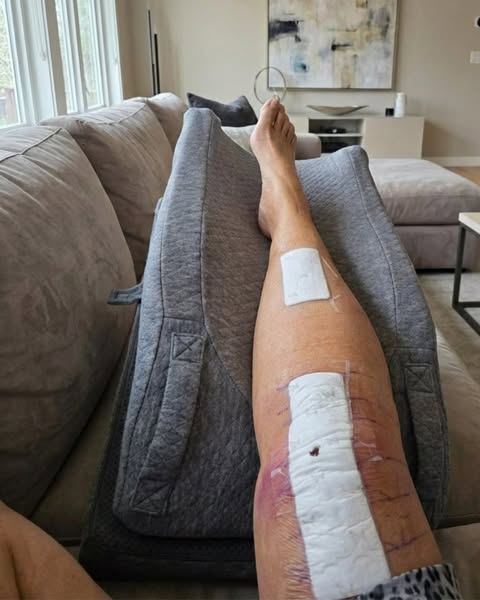 Beste Kniebandage nach der OP