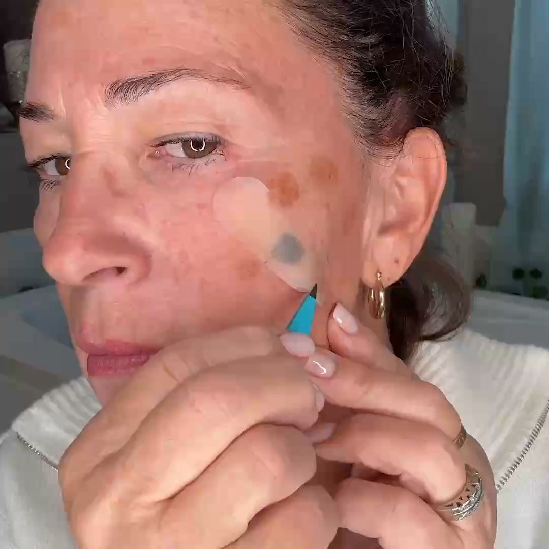 How to Stop Dark Spots Where They Start