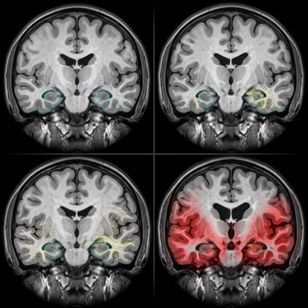 Protect your brain before it's too late
