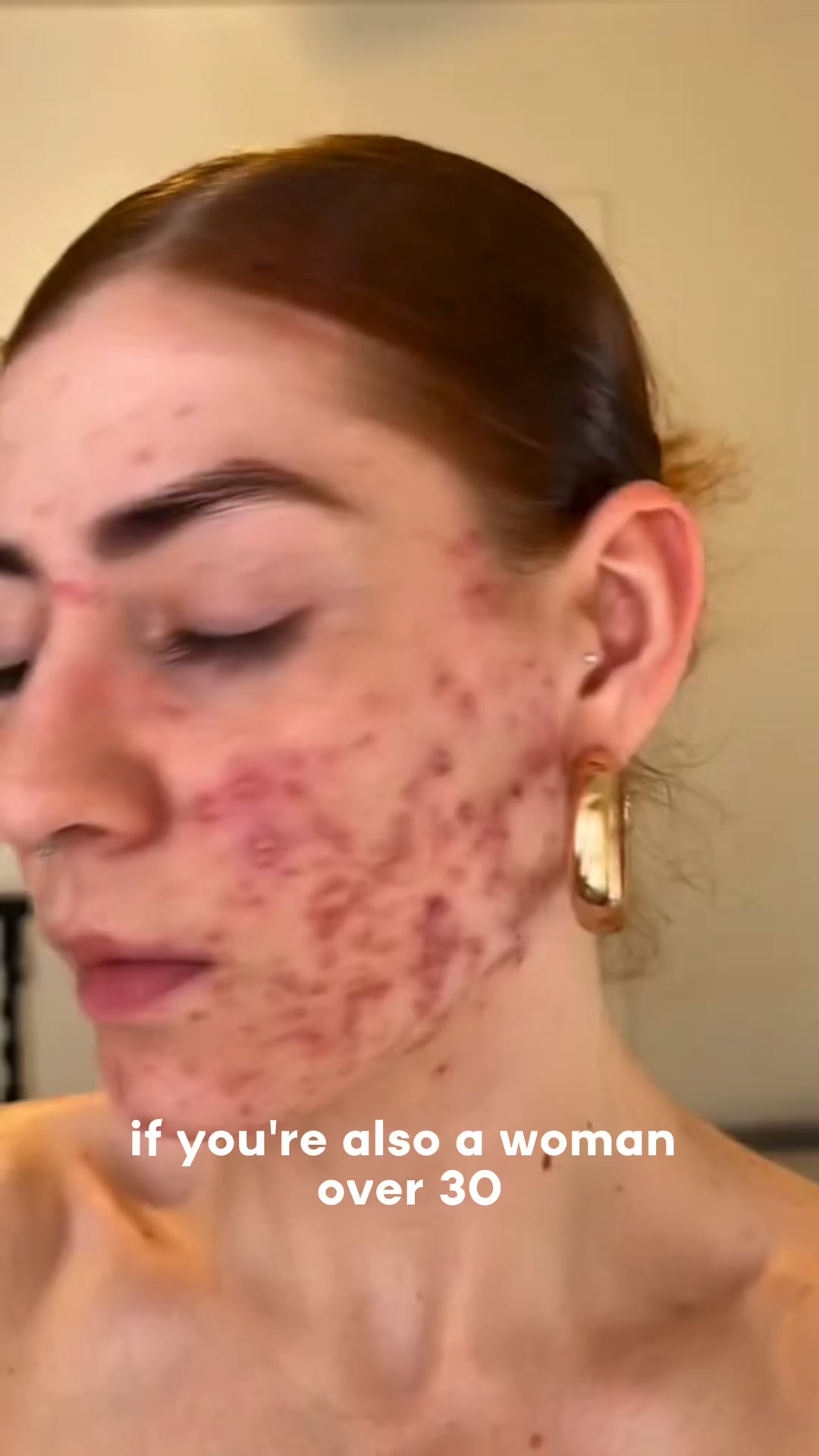 Stop destroying your skin