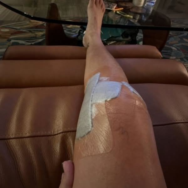 Knee Pain? Read this
