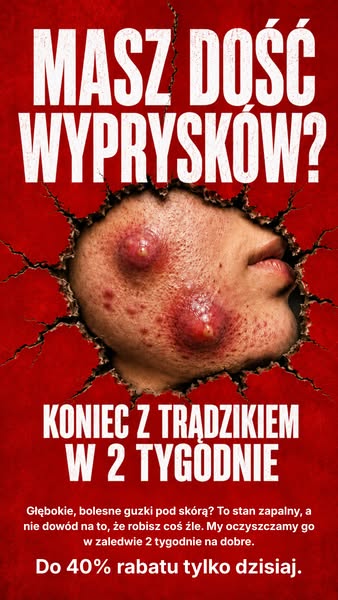 Teraz 40% zniżki