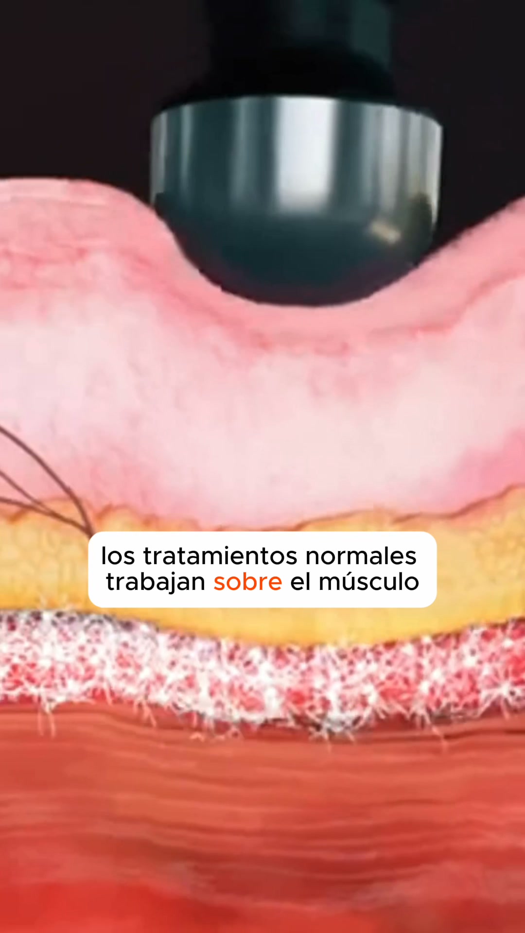 Deja de apretar. Empieza a TIRAR.