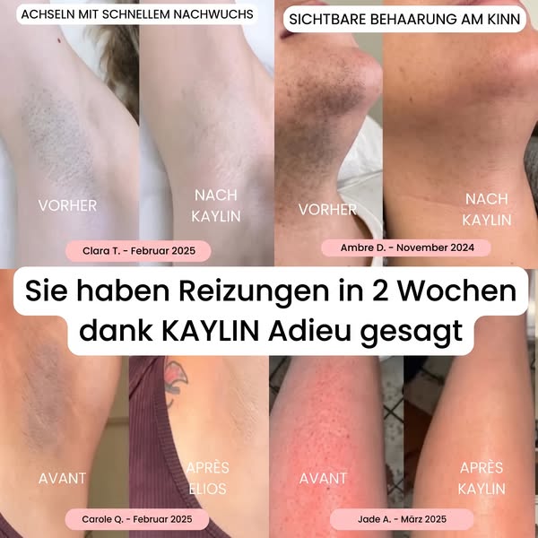 Eine hautschonende Rasur