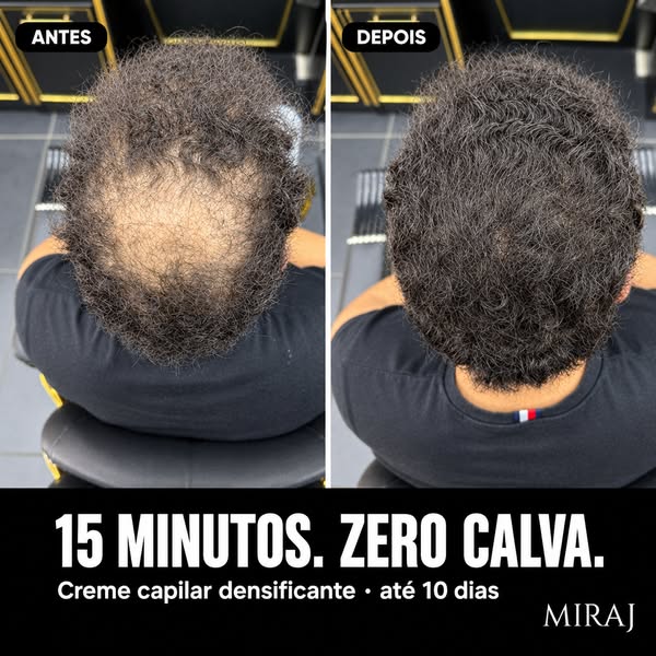 Cabelo ralo? Densidade visível em 15 minutos