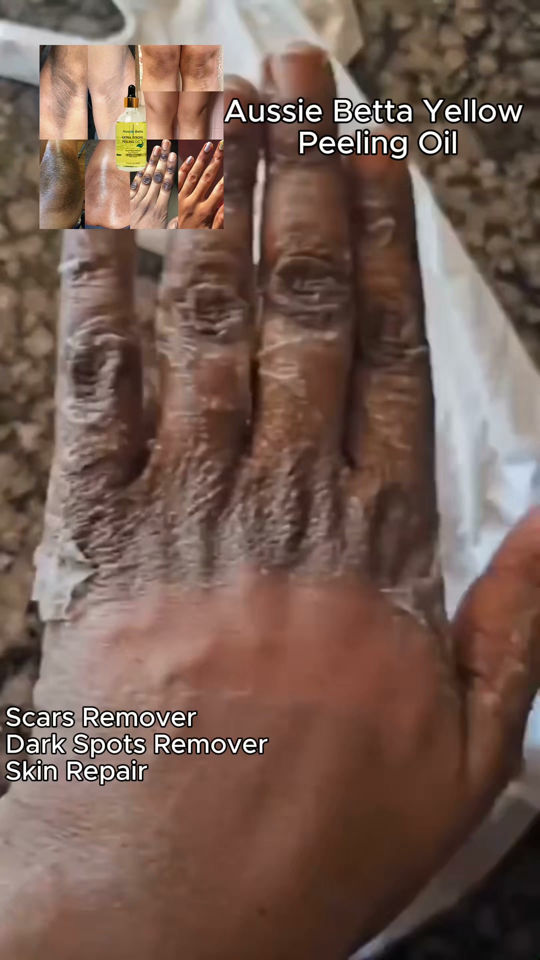 Target Rough, Uneven-Looking Knuckles