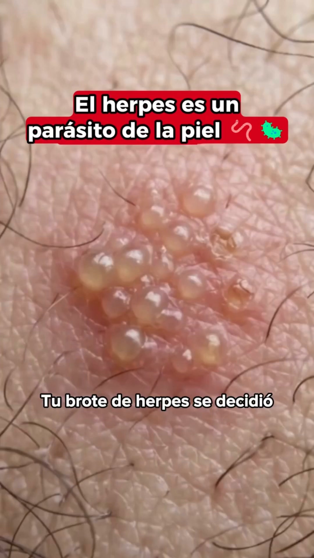 El apoyo natural más concentrado que tu cuerpo estaba esperando.