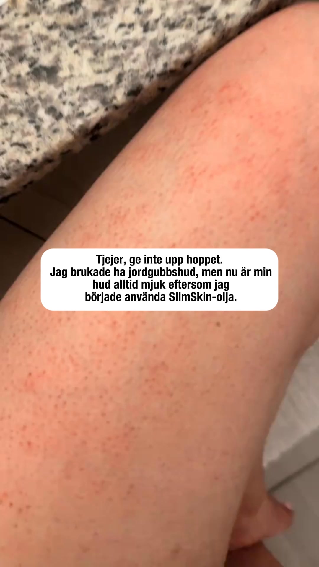 Betala senare med Klarna