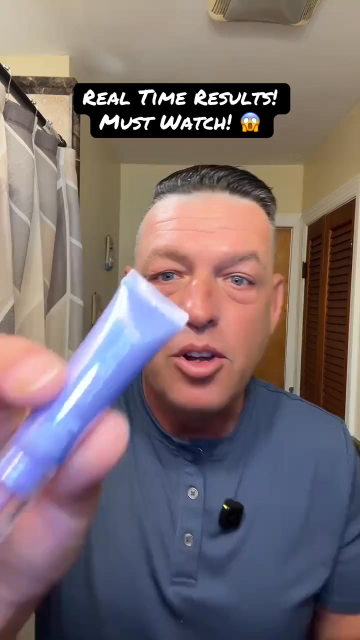 Why Is Your Eye Cream Getting "More Useless" the More You Use It? Here's the Answer!