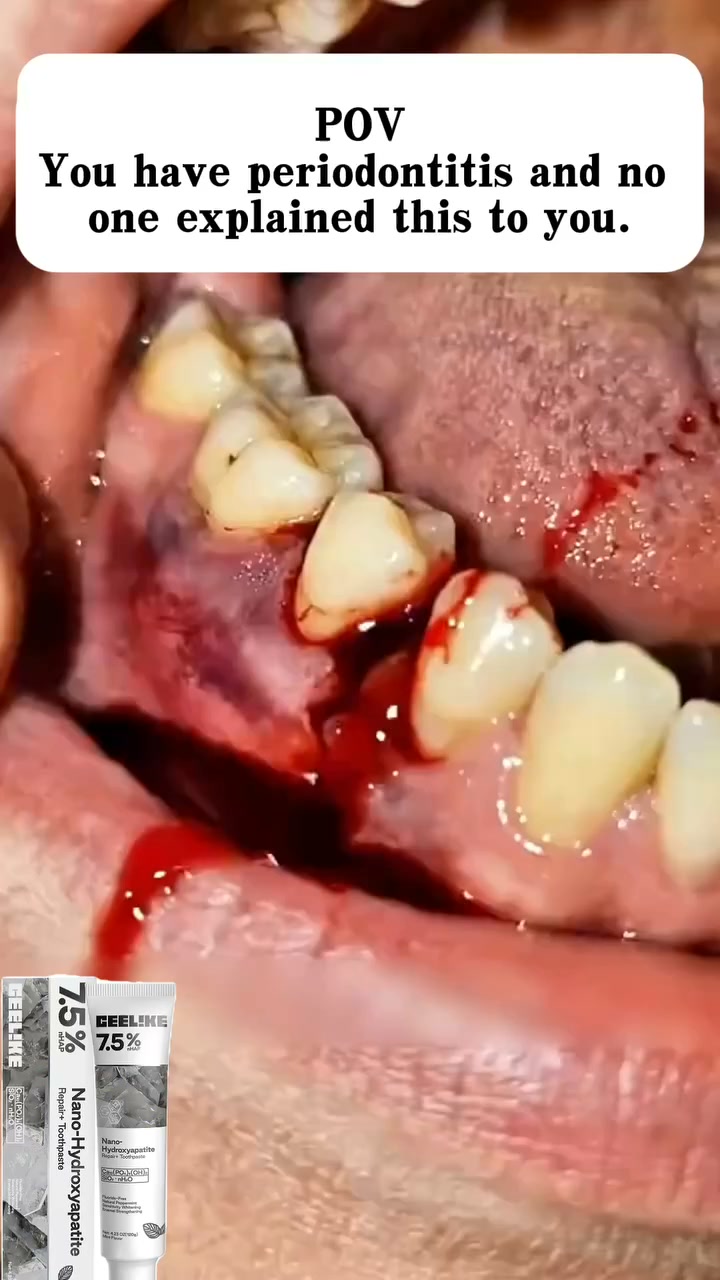 Toothpaste