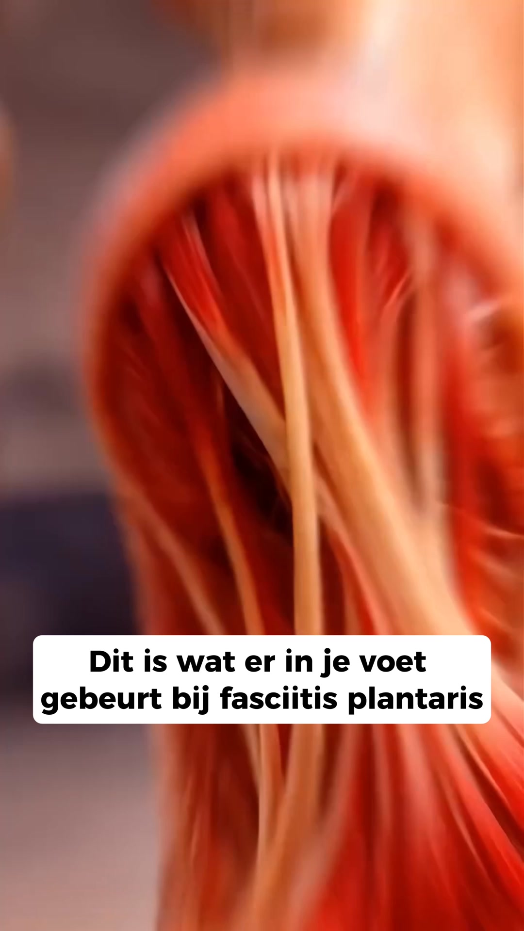 Sale eindigt binnenkort!