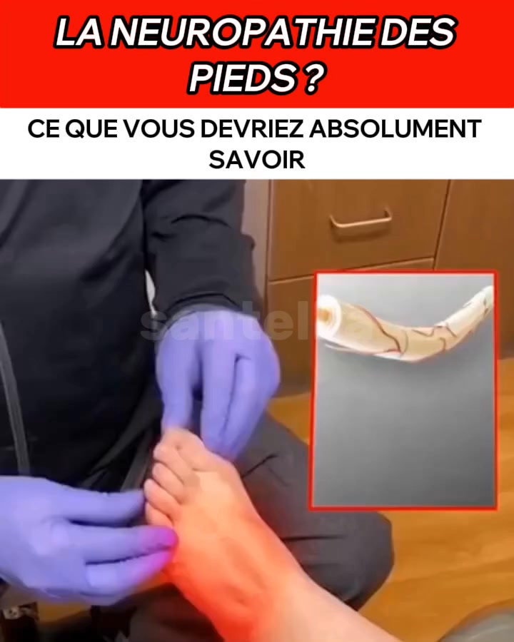Aide à soulager les douleurs neuropathiques