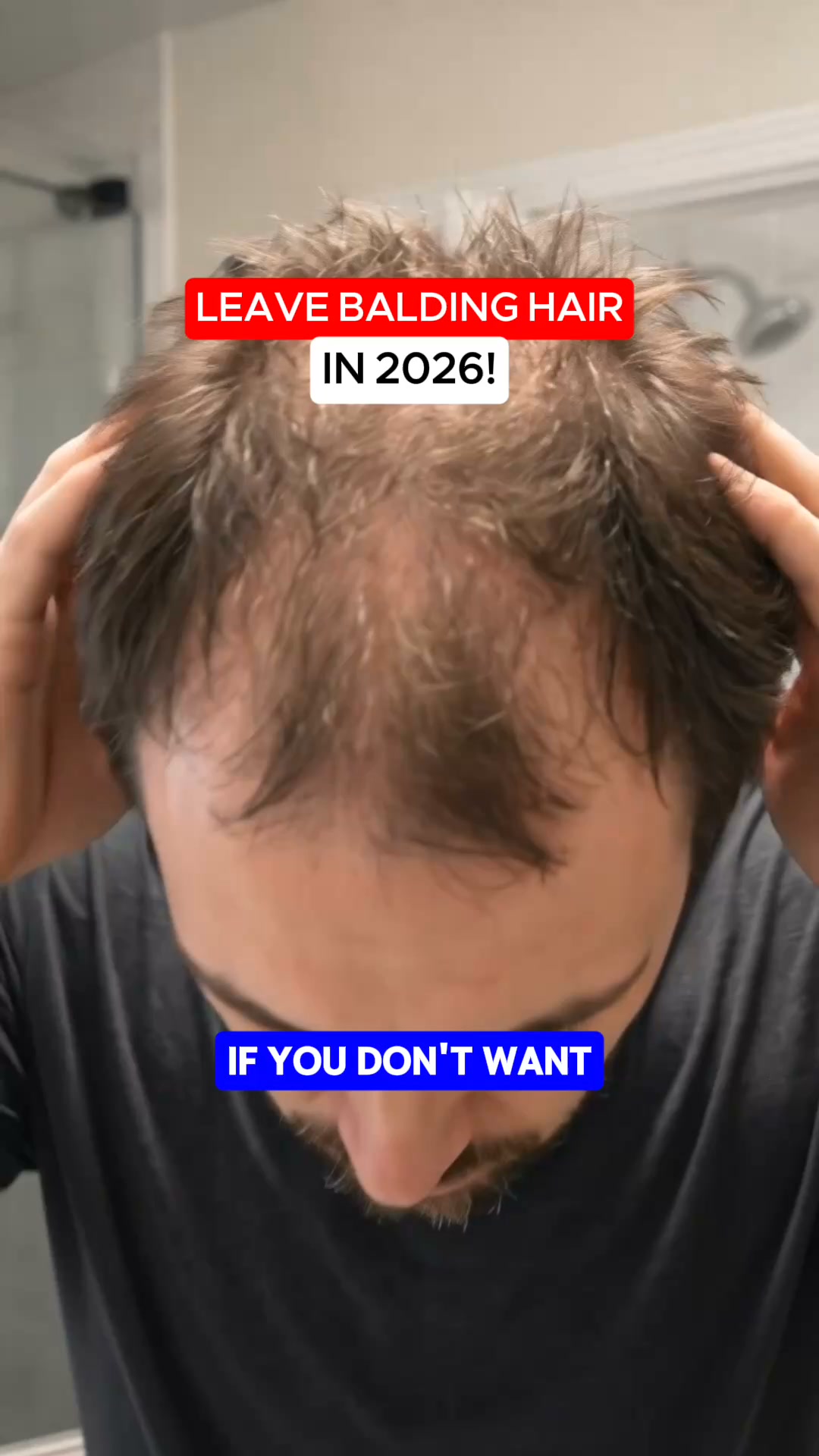 Less Scalp Showing Starts Here