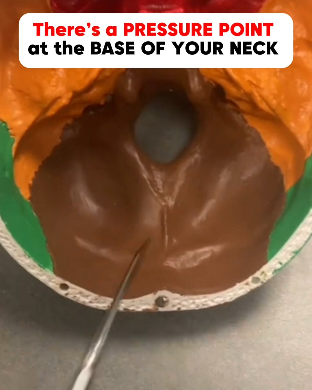 It Started With My Neck. Then It Spread.