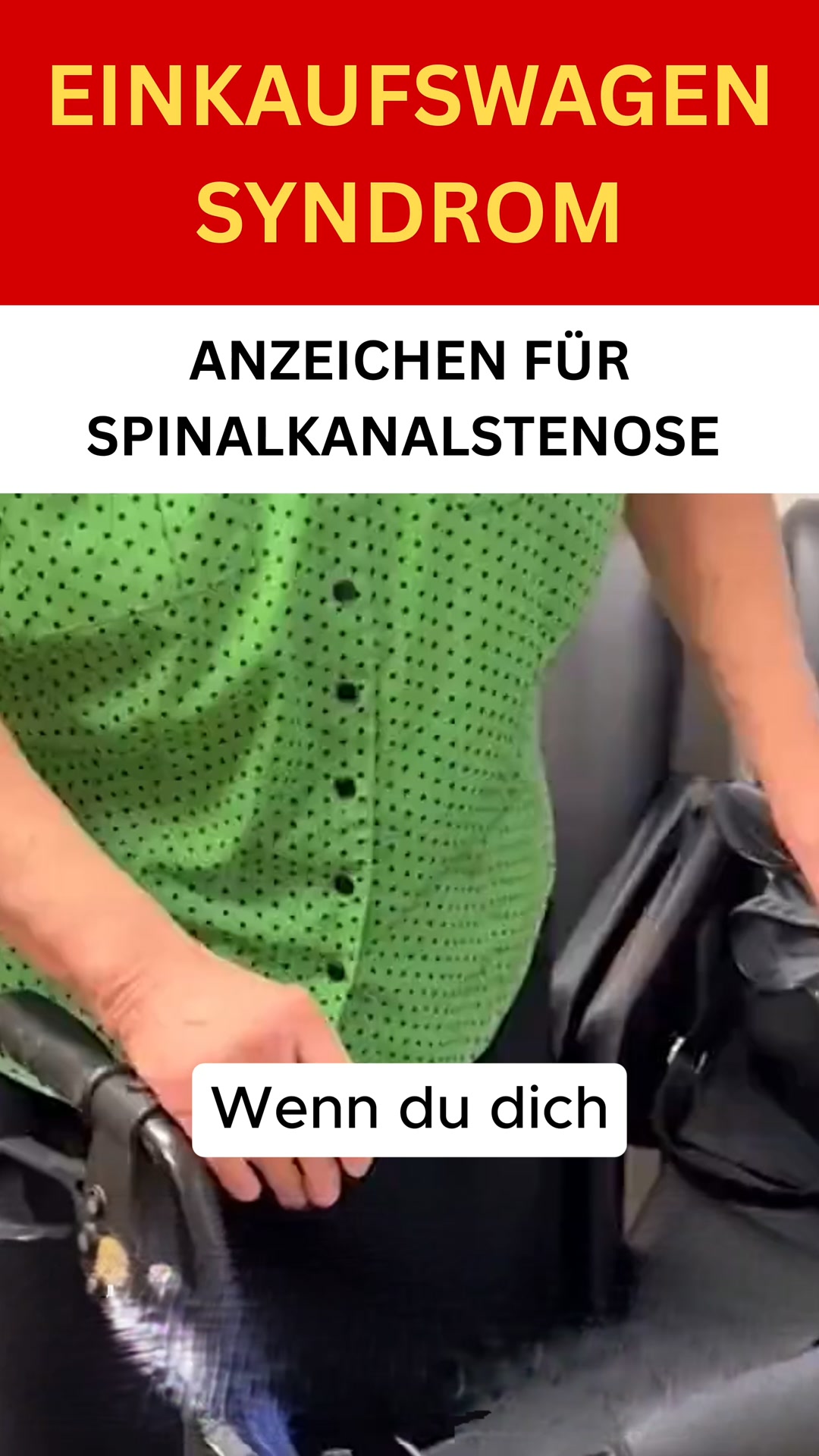 Das Einkaufswagen-Syndrom, das auf Spinalkanalstenose hinweist