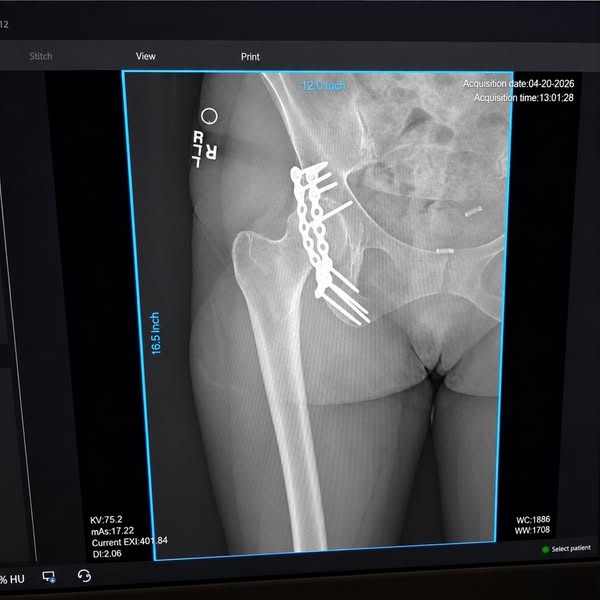 The Reason Your DEXA Numbers Won't Move