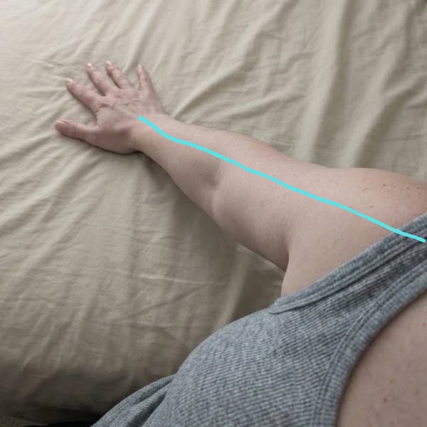 That pain is not coming from your arm…