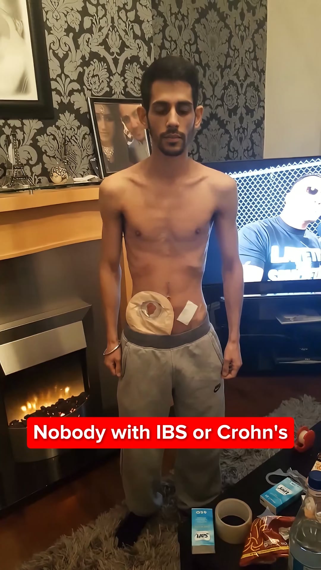 The IBS piece nobody mentions