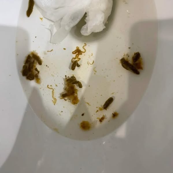 Why the Bible Warned About Parasites