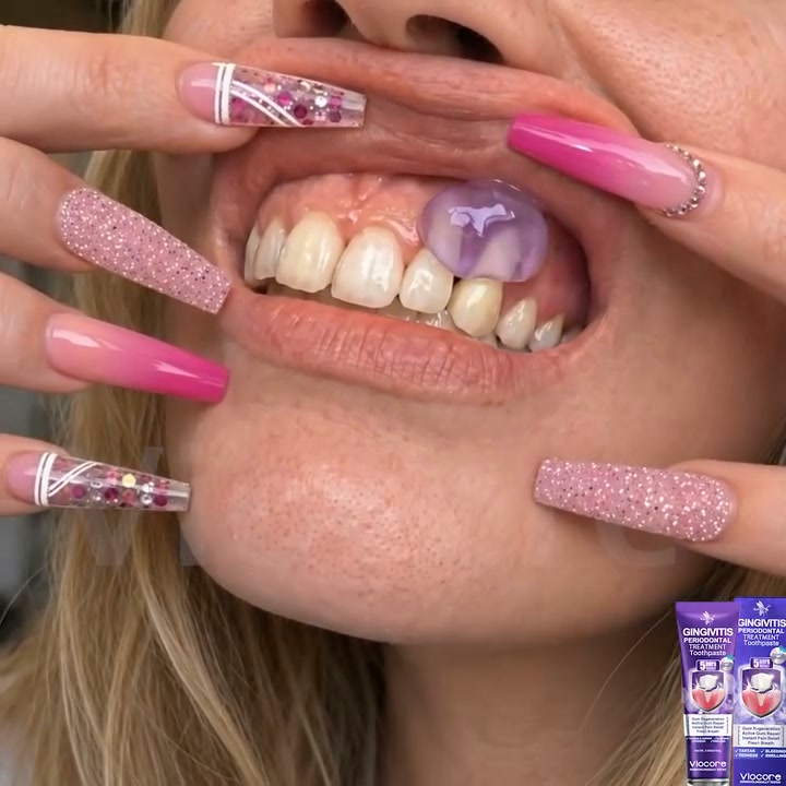 Gum Healing Endorsed by the Academy of Periodontology (AAP) | Delivery within 2-4 working days | Full refund guarantee