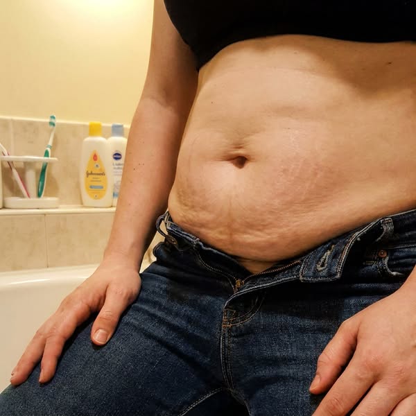 Soleane Sculpt™ | Postpartale Unterhose — 360° Kompression
