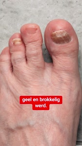 De precieze reden waarom Gezondheidsweek besloot Supplend onder de loep te nemen