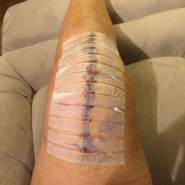 Knee Problems? Read This.