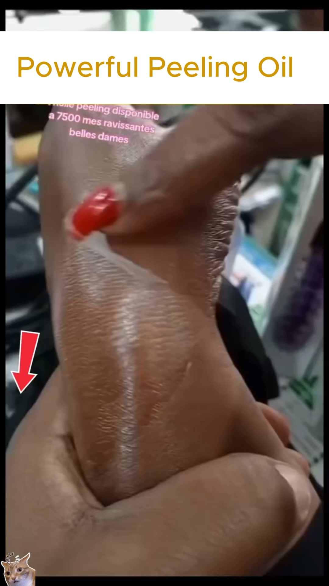 Are you tired of dealing with rough, dry and cracked skin on your hands?