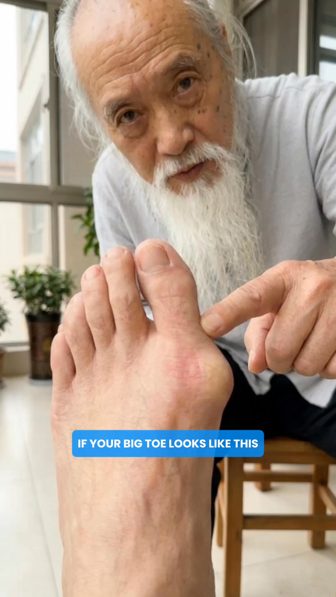 Your doctor said genetic. Your podiatrist said surgery. Both were treating the symptom.