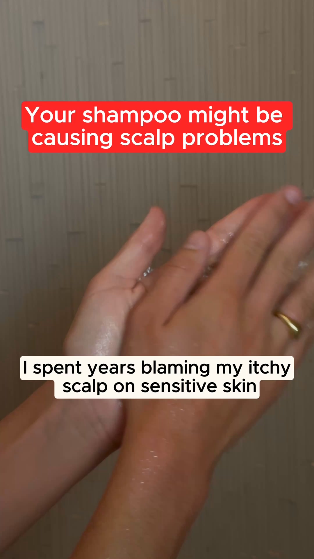 Start With Your Scalp