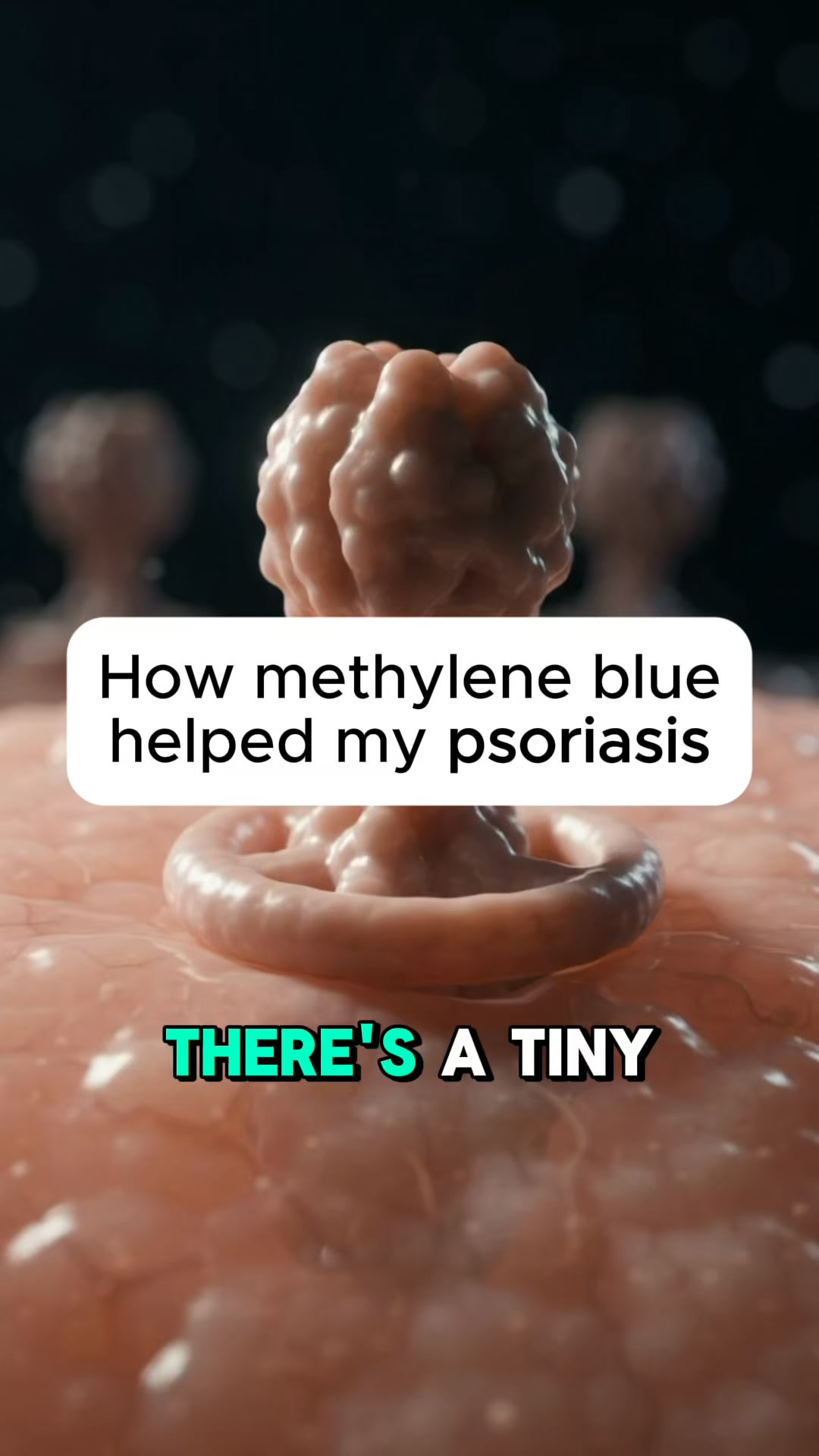 Methylene Blue. For Psoriasis. Here’s Why.
