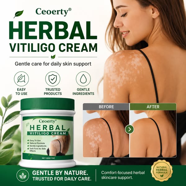 Fast and easy fix for vitiligo.